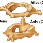   How the Axis Spine Affects Neck and Back Pain  The Hidden Connection