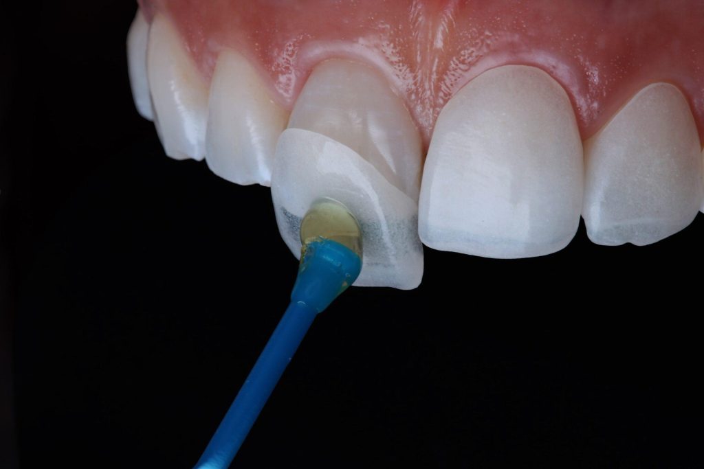 Innovations in Dental Aesthetics You Need to Know