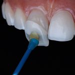 Innovations in Dental Aesthetics You Need to Know